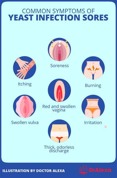 A Complete Guide To Taking Care Of Yeast Infection Sores