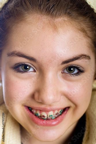 Teenaged Girl With Mouth Full Of Braces Stock Foto Adobe Stock