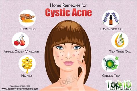 Home Remedies For Cystic Acne Skin Care Cystic Acne Remedies