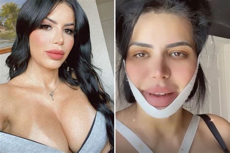 90 Day Fiances Larissa Dos Santos Lima Shows Off Plastic Surgery Scars