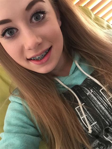 Braces Cute Young Teens Girls Braceface Georgeous Outfit Ideas