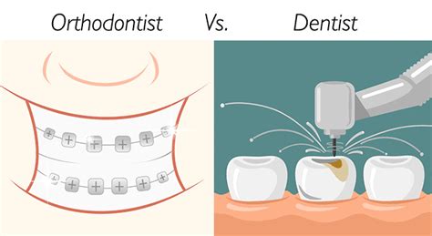 Dentist Vs Orthodontist Differences That You Need To Know