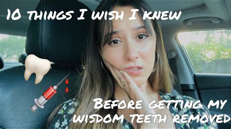 10 THINGS I WISH I KNEW BEFORE GETTING MY WISDOM TEETH REMOVED MY