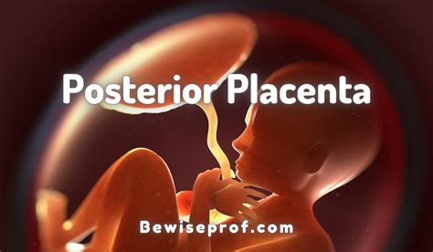Posterior Placenta Meaning Complications Delivery And All You Need