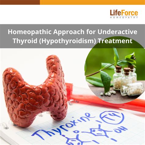 Homeopathic Approach For Underactive Thyroid Hypothyroidism Treatment