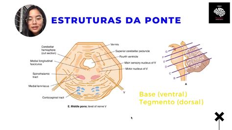Tronco Encef Lico Ponte Revis O Did Tica De Neuroanatomia Linncx Youtube