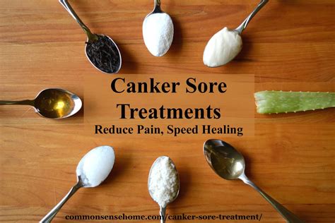 Canker Sore Treatment How To Get Rid Of Canker Sores
