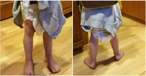 School Forced Young Boy With Learning Disability To Wear A Diaper And