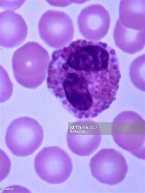 White Blood Cell Eosinophil Human Blood Smear 400x Stockfoto Getty Images
