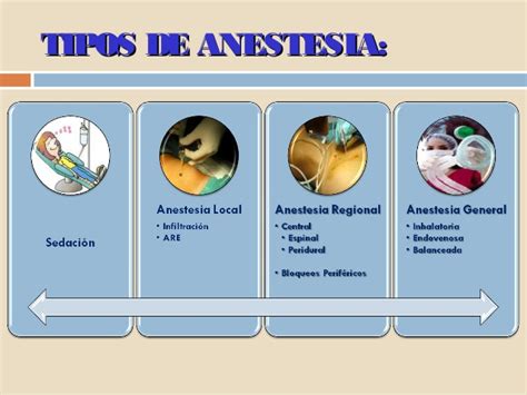 Introducción A La Anestesia Tipos De Anestesia