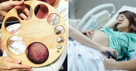 Image Showing Cervical Dilation Will Make You Appreciate All Mums