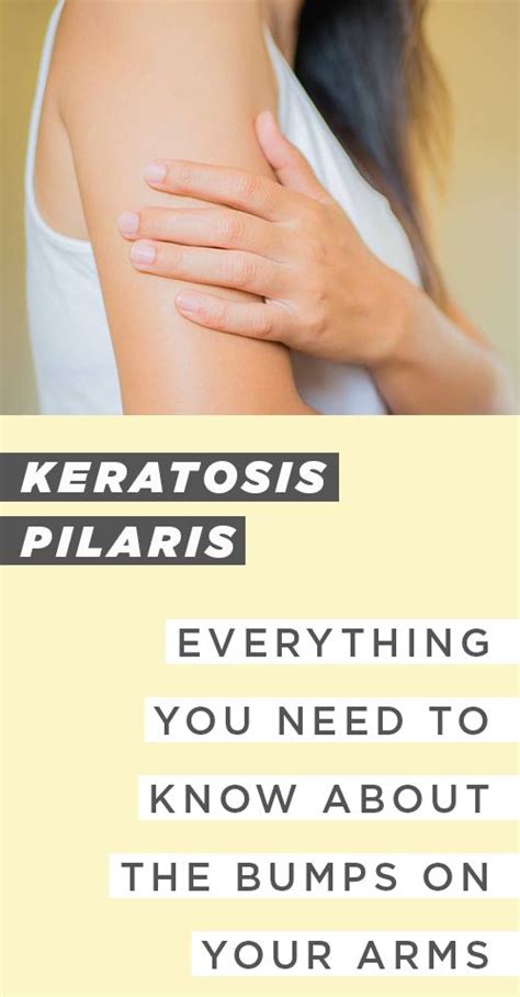 Keratosis Pilaris How To Get Rid Of Chicken Skin Bumps On Arms