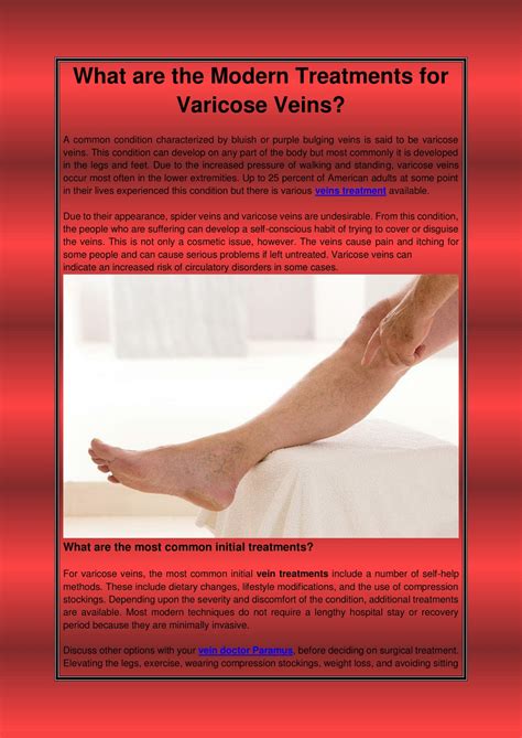 Ppt What Are The Modern Treatments For Varicose Veins Powerpoint