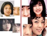 The Cloud Number Nine Korean Artists Before And After The Plastic Surgery