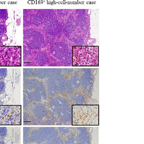 Immunostaining Of Sinus Macrophages In The Regional Lymph Node Rln Of