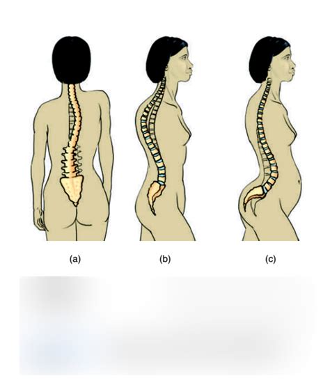 abnormal curves of the vertebral diagram quizlet