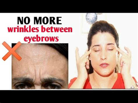 But users should get prescribed from a recognized dermatologist as most of surgical processes involve. NO MORE FROWN LINES| Get rid of Wrinkles between the ...