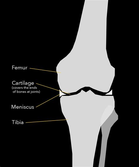 Joseph Maratt Md Knee Pain