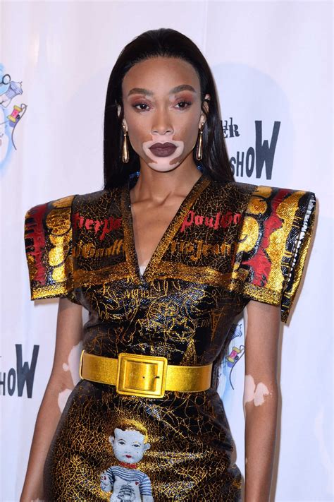 Winnie Harlow Attends The Fashion Freak Show During The Paris Fashion