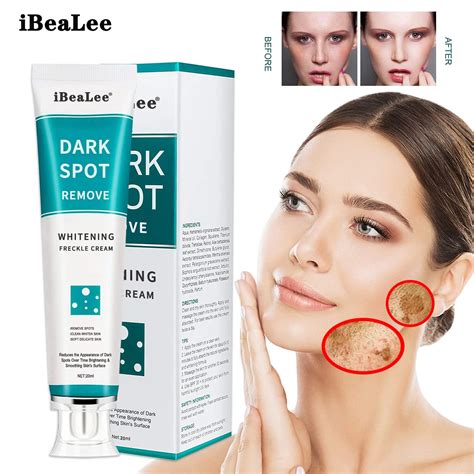 10pcs Whitening Cream Freckle Remove Melasma Cream Dark Spots Melanin Melasma Remover Brighten