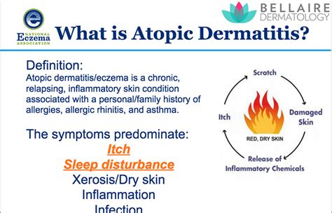 Newly Diagnosed With Atopic Dermatitis What You Need To Know Webinar
