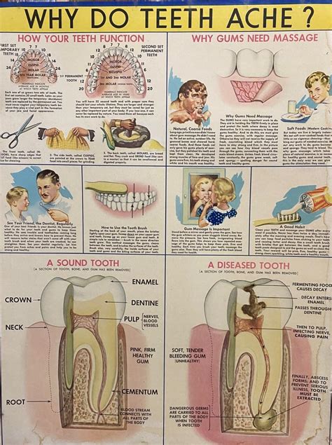 Why Do Teeth Ache Dental Poster Faculty Of Medicine Dentistry And