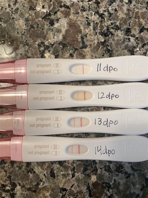 14 Dpo On A Frer A Bit Surprised As I Had An Hsg This Cycle And Have