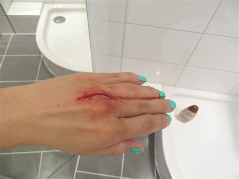 Wann müssen gehalt und lohn auf dem konto sein? Muss diese 5 cm offene Wunde jetzt genäht werden (Foto ...
