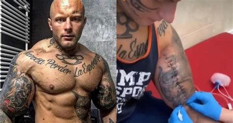 Mma Fighter Szymon Komandos Underwent Surgeries In Biceps To Save Muscles Following Synthol Use