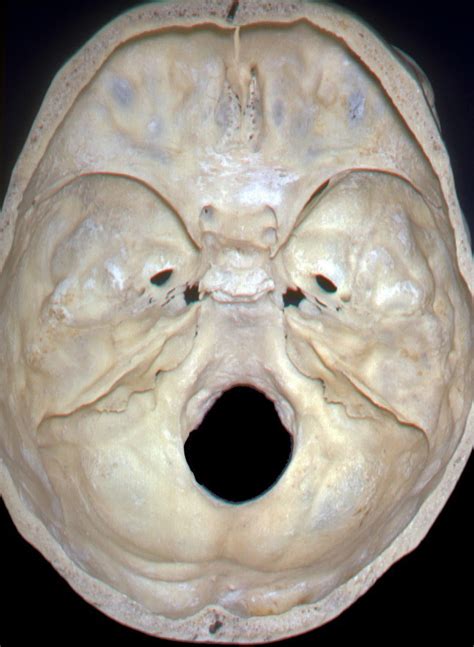 Maybe you would like to learn more about one of these? Internal Skull Base Anatomy | Neuroanatomy | The ...