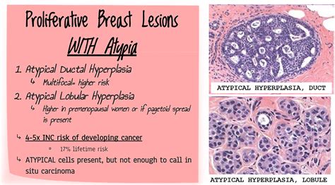 Benign Diseases Of The Breast An Overview