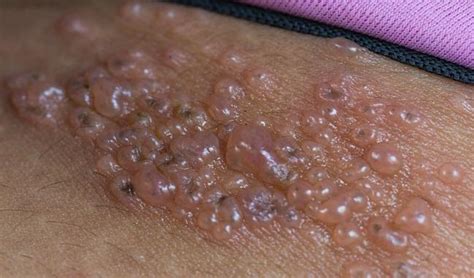 Skin Conditions Explained Warsoor