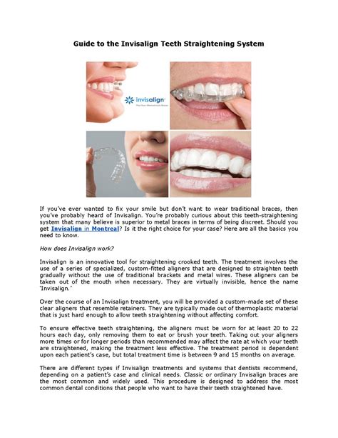 Guide To The Invisalign Teeth Straightening Systempdf Pdf Host