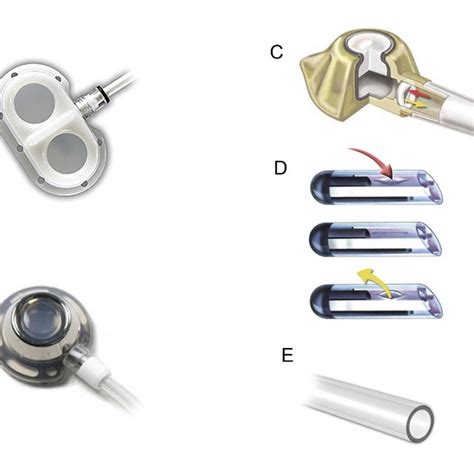 Types Of Totally Implantable Catheter Ports A Double Chamber
