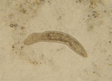 Microscopic Worm 1