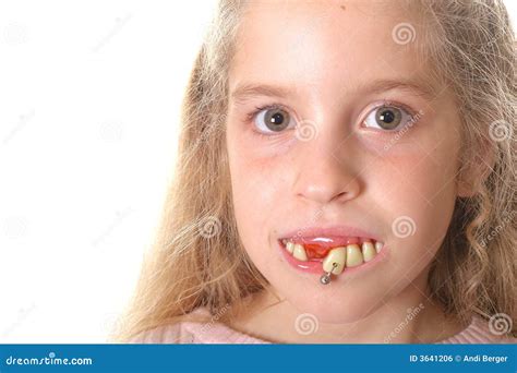 Dentes Feio De Criança