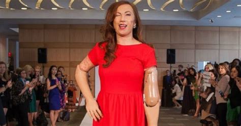 Meet Karen Crespo The Woman Who Lost Her Limbs To Meningitis And Is