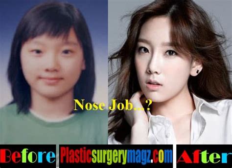 Korean Jessica Before Plastic Surgery