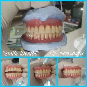 Check spelling or type a new query. AHLI GIGI PALSU " SMILE DENTAL" | Melayani Pembuatan ...