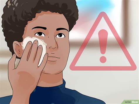 Come Trattare la Dermatite da Contatto: 15 Passaggi