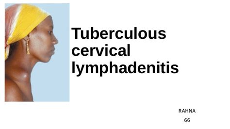 Tuberculous Cervical Lymphadinitis