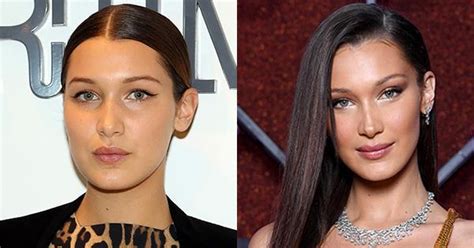 bella hadid s before and after surgery evolution elle australia