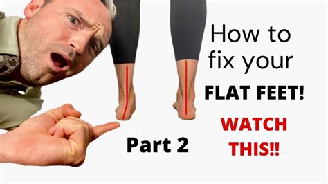 How To Fix Your Flat Feet Watch This Part 2 Youtube