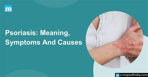 Psoriasis Meaning Symptoms And Causes Health