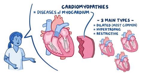 Cardiomyopathy Nursing Osmosis Video Library