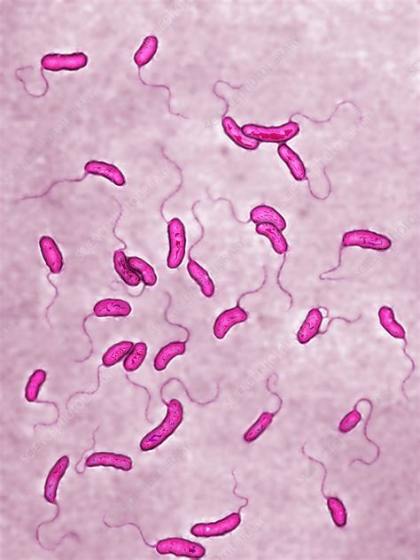 Vibrio Cholerae Bacteria Lm Stock Image C0279047 Science Photo