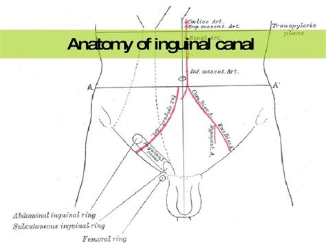 Femoral Hernia Symptoms Men Hernias And Groin Swellings Most