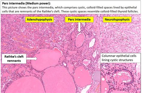 Brain Pituitary Nus Pathweb Nus Pathweb