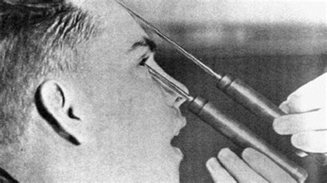 Top 10 Shocking Medical Practices Used In The Past Youtube