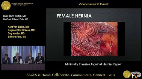 Video Face Off Panel Minimally Invasive Inguinal Hernia Repair